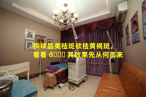 铜陵晶美祛斑欲祛黄褐斑，看看 🕊 其效果先从何而来